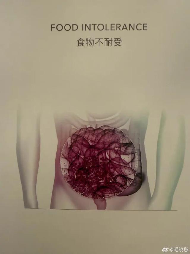 世界杯手机观看平台-演员毛晓彤凌晨从医美诊所离开引网友热议,其晒医院检测报告回应:作为一个从小爱吃面食的天津人,查出面粉不耐受可怎么办